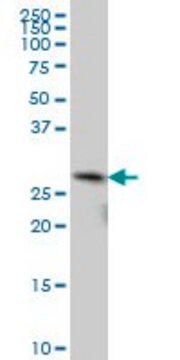 ANTI-TGIF2 antibody produced in mouse clone 5G1, purified immunoglobulin, buffered aqueous solution