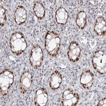 Anti-ZC3H8 antibody produced in rabbit Prestige Antibodies&#174; Powered by Atlas Antibodies, affinity isolated antibody, buffered aqueous glycerol solution