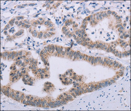 Anti-MRGPRX1 antibody produced in rabbit affinity isolated antibody