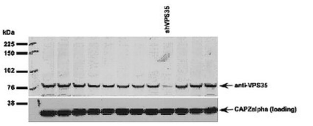 Anti-Vesicle protein sorting 35 (VPS35) Antibody from rabbit