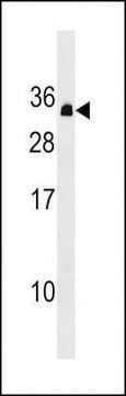 ANTI-PDCD10 (CENTER) antibody produced in rabbit affinity isolated antibody, buffered aqueous solution