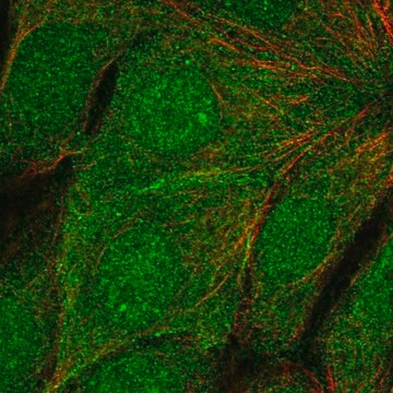 Anti-TMEM183A antibody produced in rabbit Prestige Antibodies&#174; Powered by Atlas Antibodies, affinity isolated antibody