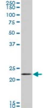 Monoclonal Anti-RAB11A antibody produced in mouse clone 1F7-2A8, purified immunoglobulin, buffered aqueous solution