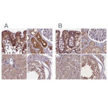 Anti-NUBP1 antibody produced in rabbit Prestige Antibodies&#174; Powered by Atlas Antibodies, affinity isolated antibody, buffered aqueous glycerol solution