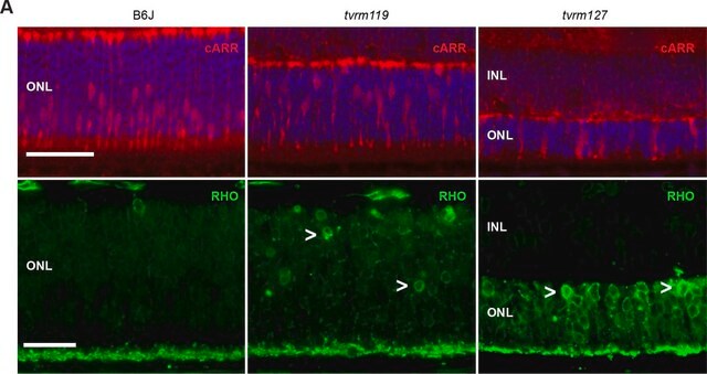 Anticuerpo anti-rodopsina, CT, 9 últimos aminoácidos, clon Rho 1D4 clone Rho 1D4, Chemicon&#174;, from mouse