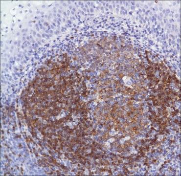 Anti-CD22 antibody, Rabbit monoclonal clone SP104, recombinant, expressed in proprietary host, affinity isolated antibody