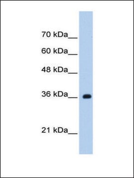 Anti-TRSPAP1 antibody produced in rabbit IgG fraction of antiserum