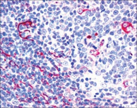 Anti-NET1/ARHGEF8, C-Terminal antibody produced in goat affinity isolated antibody, buffered aqueous solution