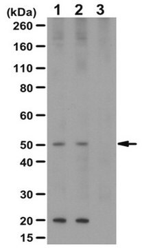 Anti-phospho-GLUT-1-Antikörper (Ser226) from rabbit, purified by affinity chromatography