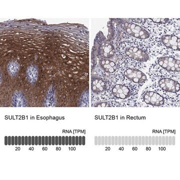 Anti-SULT2B1 antibody produced in rabbit Prestige Antibodies&#174; Powered by Atlas Antibodies, affinity isolated antibody, buffered aqueous glycerol solution