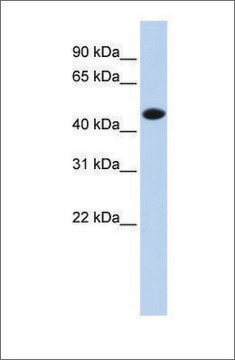 Anti-CKM (ab1) antibody produced in rabbit affinity isolated antibody