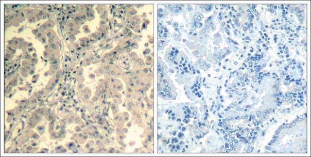 Anti-STAT2 (Ab-690) antibody produced in rabbit affinity isolated antibody