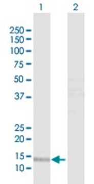 Anti-PTS antibody produced in rabbit purified immunoglobulin, buffered aqueous solution