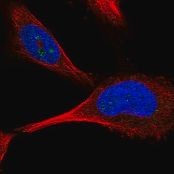 Anti-PFKFB4 antibody produced in rabbit Prestige Antibodies&#174; Powered by Atlas Antibodies, affinity isolated antibody