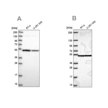 Anti-IPO4 antibody produced in rabbit Prestige Antibodies&#174; Powered by Atlas Antibodies, affinity isolated antibody, buffered aqueous glycerol solution