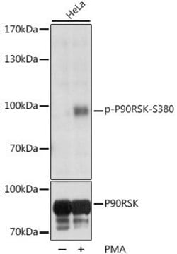 Anti-Phospho-P90RSK-S380 antibody produced in rabbit