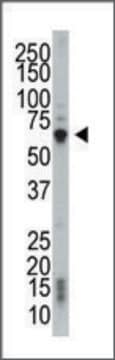 Anti-PACSIN2 (center) antibody produced in rabbit IgG fraction of antiserum, buffered aqueous solution