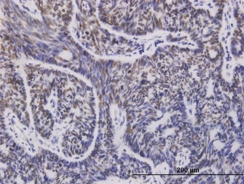 Monoclonal Anti-UBE2D1 antibody produced in mouse clone 2C6, purified immunoglobulin, buffered aqueous solution