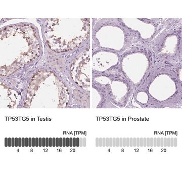 Anti-TP53TG5 antibody produced in rabbit Prestige Antibodies&#174; Powered by Atlas Antibodies, affinity isolated antibody, buffered aqueous glycerol solution