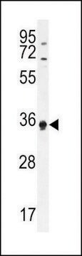 ANTI-ECAT1(N-TERMINAL) antibody produced in rabbit affinity isolated antibody, buffered aqueous solution