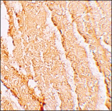 Anti-VPS39 antibody produced in rabbit affinity isolated antibody