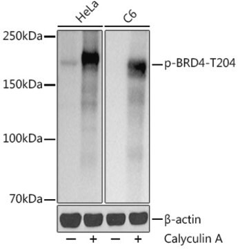 Anti-Phospho-BRD4(pThr204) Antibody, clone 3V5R1, Rabbit Monoclonal