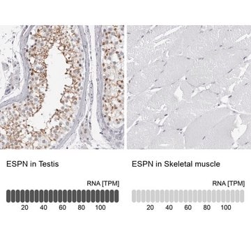 Anti-ESPN antibody produced in rabbit affinity isolated antibody, buffered aqueous glycerol solution