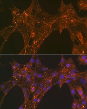 Anti-&#945;-Actinin-4 Antibody, clone 5Y3R6, Rabbit Monoclonal