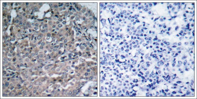 Anti-PTK2 (Ab-925) antibody produced in rabbit affinity isolated antibody