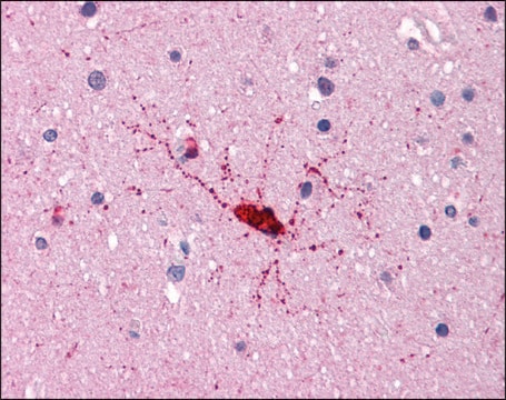 Anti-BCAS1 / NABC1 antibody produced in rabbit affinity isolated antibody