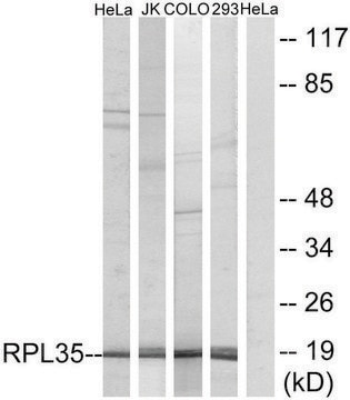 Anti-RPL35 antibody produced in rabbit affinity isolated antibody