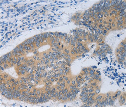 Anti-MT2A antibody produced in rabbit affinity isolated antibody