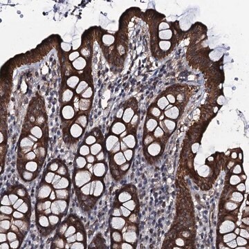 Anti-EVX2 antibody produced in rabbit Prestige Antibodies&#174; Powered by Atlas Antibodies, affinity isolated antibody, buffered aqueous glycerol solution