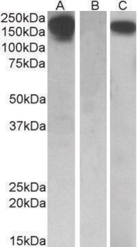 Anti-CSF1R antibody produced in goat affinity isolated antibody, buffered aqueous solution