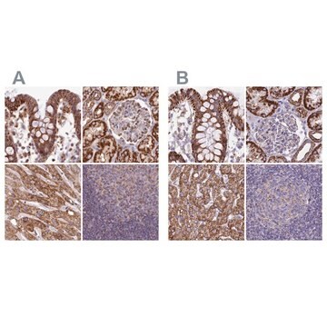 Anti-HSDL2 antibody produced in rabbit Prestige Antibodies&#174; Powered by Atlas Antibodies, affinity isolated antibody, buffered aqueous glycerol solution