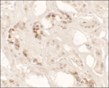 Anti-KANK2 antibody produced in rabbit affinity isolated antibody, buffered aqueous solution