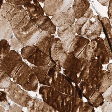 Anti-TAB3 antibody produced in rabbit Prestige Antibodies&#174; Powered by Atlas Antibodies, affinity isolated antibody, buffered aqueous glycerol solution