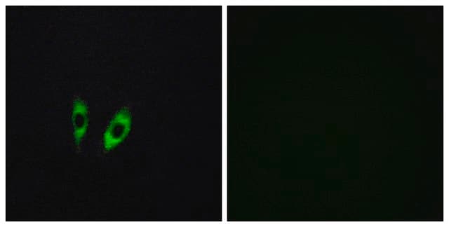 Anti-GPR156 antibody produced in rabbit affinity isolated antibody