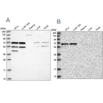 Anti-SIAE antibody produced in rabbit Prestige Antibodies&#174; Powered by Atlas Antibodies, affinity isolated antibody, buffered aqueous glycerol solution