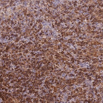 Anti-LYPD6B antibody produced in rabbit Prestige Antibodies&#174; Powered by Atlas Antibodies, affinity isolated antibody, buffered aqueous glycerol solution