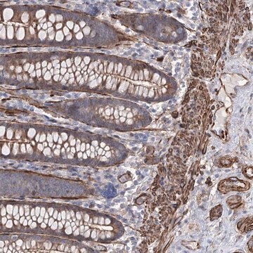 Anti-ARHGAP20 antibody produced in rabbit Prestige Antibodies&#174; Powered by Atlas Antibodies, affinity isolated antibody, buffered aqueous glycerol solution