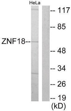 Anti-ZNF18 antibody produced in rabbit affinity isolated antibody