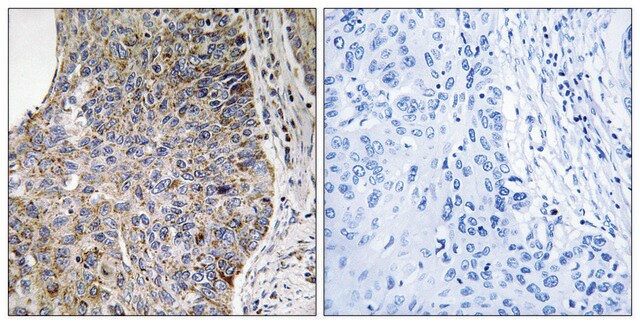 Anti-NEK7 antibody produced in rabbit affinity isolated antibody