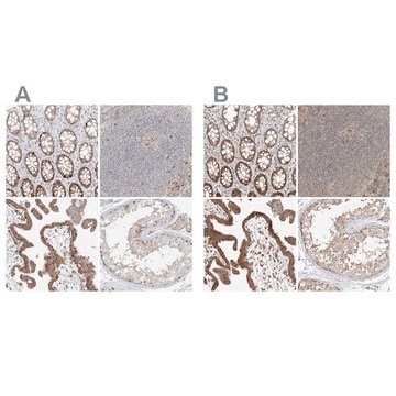 Anti-BYSL antibody produced in rabbit Prestige Antibodies&#174; Powered by Atlas Antibodies, affinity isolated antibody, buffered aqueous glycerol solution, ab1