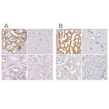 Anti-CSN1S1 antibody produced in rabbit Prestige Antibodies&#174; Powered by Atlas Antibodies, affinity isolated antibody