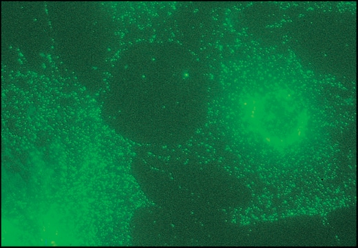 Monoclonal Anti-&#946;1 and &#946;2-Adaptins antibody produced in mouse clone 100/1, ascites fluid