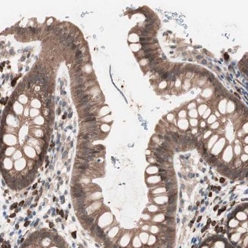 Anti-ALG5 antibody produced in rabbit Prestige Antibodies&#174; Powered by Atlas Antibodies, affinity isolated antibody, buffered aqueous glycerol solution