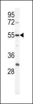 ANTI-PKM1 (C-TERM L398) antibody produced in rabbit purified immunoglobulin, buffered aqueous solution