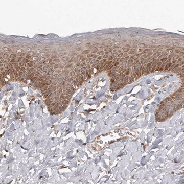 Anti-WEE2 antibody produced in rabbit Prestige Antibodies&#174; Powered by Atlas Antibodies, affinity isolated antibody, buffered aqueous glycerol solution