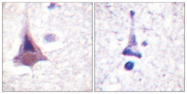 Anti-MYPT1 antibody produced in rabbit affinity isolated antibody